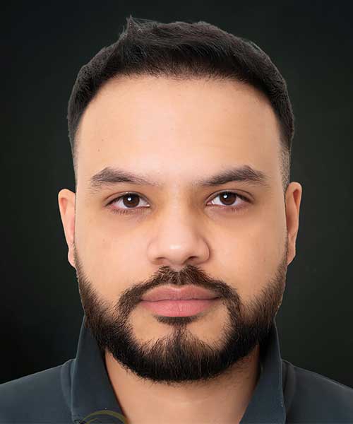 Hair Transplant